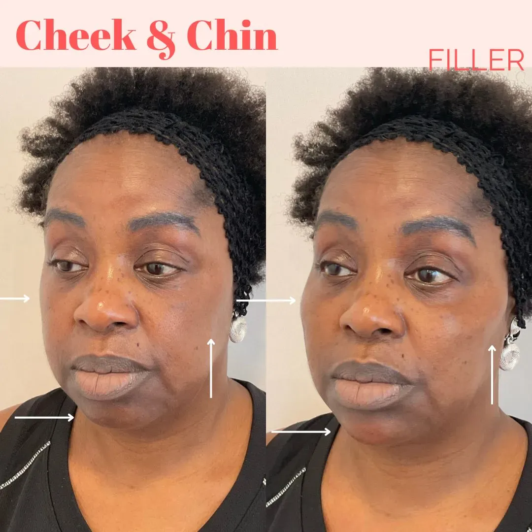 filler website_min
